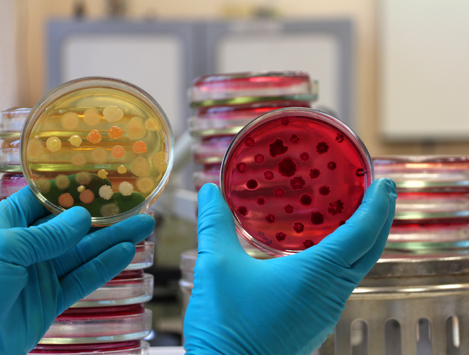 Doctor compares two agar petri samples and microbial colonies